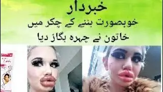 Khoob Surat Nazar any ke chakar mein ladki ne apna chehra bigad diya
