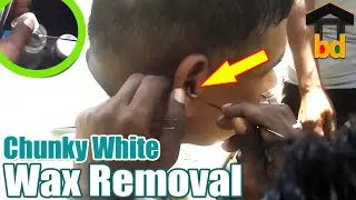 ►Simple is the Best II Traditional Ear Cleaning at Roadside ASMR BD II Satisfactory Ear Waxing