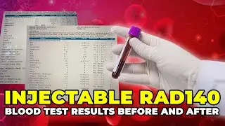 Injectable RAD140 Blood Test Results Before And After - Injectable SARMs Research