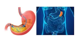 SPLEEN & STOMACH PATTERN DIFFERENTIATION