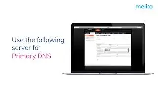 How to configure your static IP on Arris modem