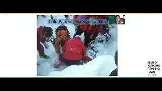 Management of cardiac arrest: focus on hypothermic patients