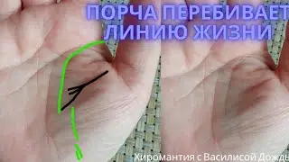 Линия негатива на руке перебивает линию жизни. Порча ищет слабое звено
