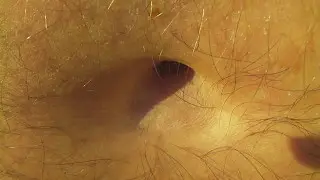 Ya Fat So - Belly Button Close Up