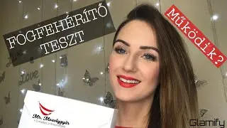 Mr. Mosolygyár otthoni fogfehérítés | TESZT | + NYEREMÉNYJÁTÉK
