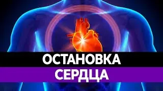 ОСТАНОВКА СЕРДЦА. ИНФАРКТ. СЕРДЕЧНЫЙ ПРИСТУП.