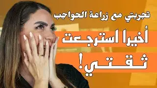 تجربتي مع زراعة الحواجب | مرينا