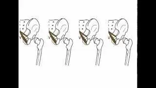 Gluteal region