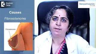 Cancerous Breast Lumps | Breast Lumps Treatment | Dr. Poonam Patil | Oncology - Manipal Hospitals
