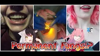 Getting Permanent Vampire Fangs! // Vlog // Tooth Bonding