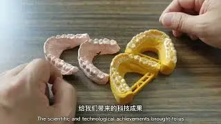 Matching 3D printed model to plaster model