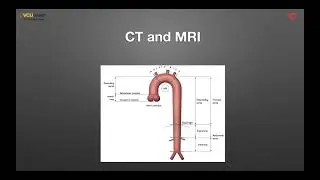Cardiac Imaging in Pregnancy