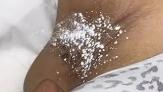 UNDERARM WAX 💋💋 Extractions & High Frequency #lekrewecire