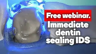 Immediate Dentin Sealing (IDS). Free webinar.