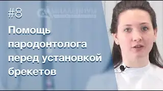 ✅ Помощь пародонтолога перед ортодонтическим лечением.