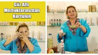 Gözaltı Morluklarından Kurtulun!