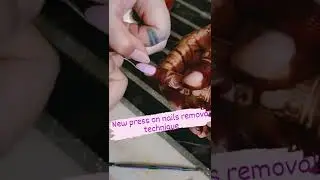 Easy Nail removal technique #shorts #viralvideo