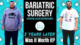 Weight Loss Surgery I 3 Years Later I My Story