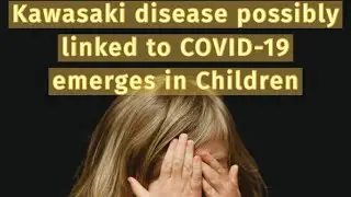 Pediatric inflammatory syndrome related to COVID-19 observed in children|COVID19|Corona