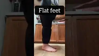 Why you should walk barefoot ep 12 | Flat feet 