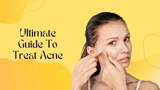 Ultimate Guide To Treat Acne | Get Rid of Acne