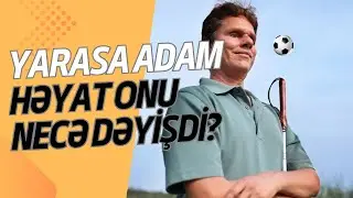 Yarasa adam - həyat onu necə dəyişdi? (Daniel Kish)