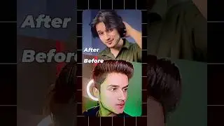 3 Hair care Hacks ✅   #shortsindia #haircare #hairgrowth #dandruff #hairfall