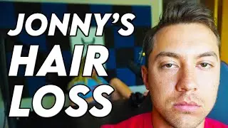 The Wieners - Jon is losing hair | God help me