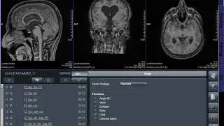 brain dot engine MRI