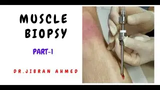 MUSCLE BIOPSY II PART 1 II POST GRADUATE LEARNING II BIOPSY SERIES II SIMPLY PATHOLOGY