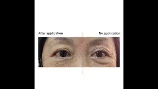 Younger looking Eyes in Just 5 Minutes! - Novexpert