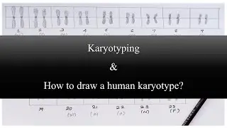 What is Karyotyping and How to draw a human karyotype?