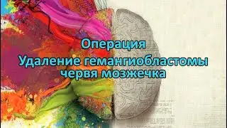 Операция. Удаление гемангиобластомы червя мозжечка. Removal of cerebellar hemangioblastoma