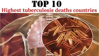 TOP 10-Highest tuberculosis deaths countries