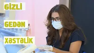Gizli kecən xəstəlik.|Doktor men💊