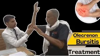 Olecranon Bursitis in Elbow | Olecrenon Brisitis Treatment