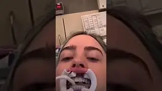 Billie Eilish at the dentist #shorts