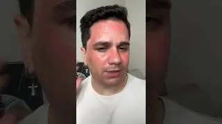 Parte 01 testando uma nova técnica para o queimadinho do sol! #shorts