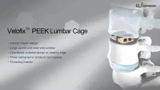 Velofix™ PEEK Lumbar Cage