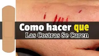 Cómo hacer que las costras se curen más rápido