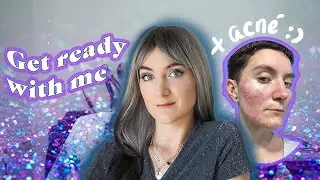 J'essaie une perruque, ma bataille avec l'acné, bilan de l'année.... GRWM