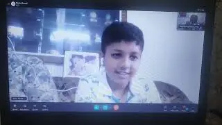 Aarush 11yrs Before 2 Weeks* Course Treatment. Call: - + 91 85276 89827