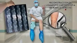 ME OPERARON LA RODILLA  (RECONSTRUCCION DE LIGAMENTO PATELOFEMORAL + ARTROSCOPIA DE RODILLA DERECHA)