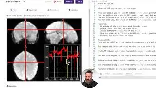 Exploring Open Source Brain MRI Data with Python | Building a 3D MRI Viewer Using Flask!