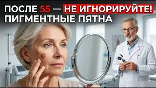🚨 ПИГМЕНТНЫЕ ПЯТНА ПОСЛЕ 55 НЕ СЛУЧАЙНОСТЬ! Дерматологи знают причину, но молчат