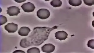 Globulo blanco vs bacteria con musica de linkin park de fondo