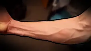 Ayooo Vein Check