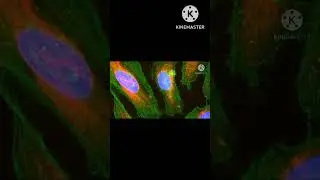 HeLa Cells @EnteMicrobialWorld #microbiology #microbes #bacteria #shortsfeed #education #biology
