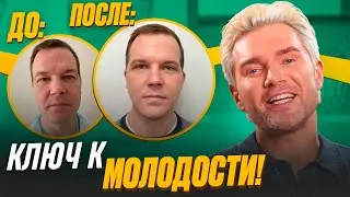 Как стать моложе на 20 лет? Фейслифтинг. Смас-подтяжка. SMAS-лифтинг. Подтяжка лица. Омоложение лица