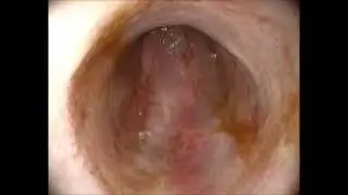 hemorrhagic gastroenteritis in a dog